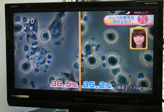 ９／６OA「あさイチ～スゴ技Ｑ　夏の疲れを“リンパ”で解消」