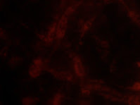 蛍光顕微鏡観察：Rhodamine123染色　生細胞に取り込まれミトコンドリアに蓄積