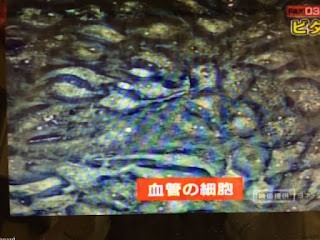 9/16OA；NHKあさイチ-ガッテンコラボ　ビタミンパワー全開！にて弊社の映像が使用されました