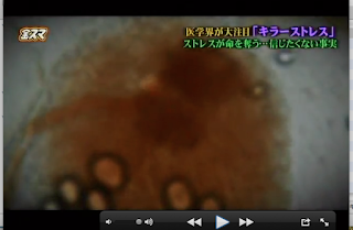 ライブラリー；20160826OA ＴＢＳ「中居正広の金曜日のスマイルたちへ」 キラーストレスの回で弊社の映像が使用されました