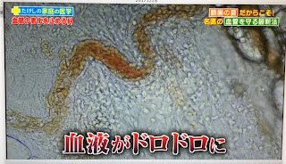 0724名医とつながる！たけしの家庭の医学で弊社の映像が使用されました。