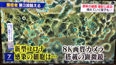本日5/2のNHK ニュースセブンでも報道;新型コロナウイルスによって壊れていく細胞の映像です