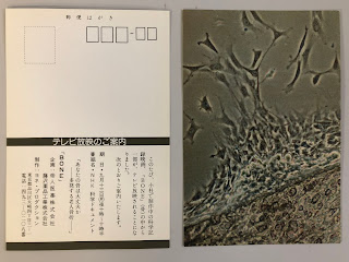 昔のヨネ・プロ絵葉書（絵はがき）：おそらく１９８４年前後？の骨芽細胞の写真とお知らせ