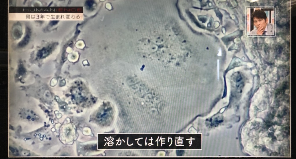 6/7OAのNHKヒューマニエンス「骨；硬くてしなやかな仕事人」に弊社の映像が使用されました