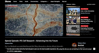 NHK World JAPAN  Science View（28分）iPS細胞研究～新時代に向かって～  iPS Cell Research  Advancing into the Future