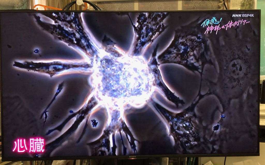 NHK ４K放送「体感！神秘の体内ツアー」で弊社の映像が使用されました