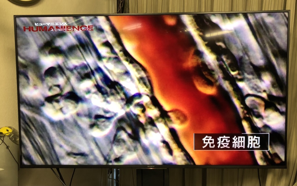 2025年11月15日OAヒューマニエンス４０億年のたくらみ＃101アレルギーの回に弊社映像が使用されました。